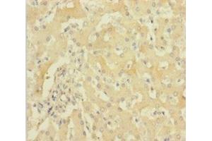 Immunohistochemistry of paraffin-embedded human liver tissue using ABIN7154984 at dilution of 1:100 (HBG1 anticorps  (AA 2-147))