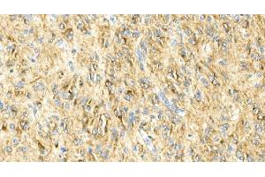 IHC analysis of GFAP using anti-GFAP antibody (ABIN7602675).
