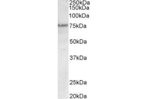 Western Blotting (WB) image for anti-Transformation Related Protein 63 (TRP63) (N-Term), (Trp63) antibody (ABIN2465086) (TRP63 anticorps  (N-Term, Trp63))