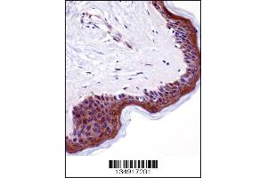 LSM14A Antibody immunohistochemistry analysis in formalin fixed and paraffin embedded human skin tissue followed by peroxidase conjugation of the secondary antibody and DAB staining. (LSM14A anticorps  (C-Term))