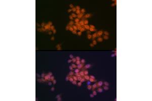 Immunofluorescence analysis of HeLa cells using WAPL Rabbit mAb (ABIN7271380) at dilution of 1:100 (40x lens).