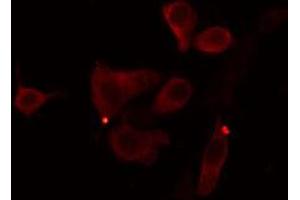 ABIN6274390 staining Hela cells by IF/ICC.
