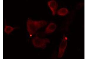 ABIN6274390 staining Hela cells by IF/ICC. (AGPAT9 anticorps  (Internal Region))