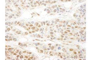 Immunohistochemistry (IHC) image for anti-Megakaryoblastic Leukemia (Translocation) 1 (MKL1) (AA 700-750) antibody (ABIN7448669)