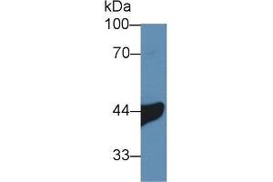 Detection of IL3Ra in Human A549 cell lysate using Polyclonal Antibody to Interleukin 3 Receptor Alpha (IL3Ra) (IL3RA anticorps  (AA 167-331))