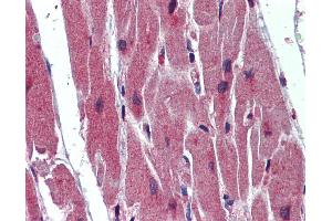 Anti-SRSF11 / SFRS11 antibody IHC of human heart.