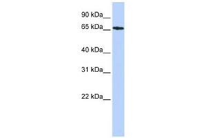 SDCCAG8 antibody used at 1 ug/ml to detect target protein. (SDCCAG8 anticorps  (Middle Region))
