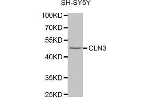Western blot analysis of extracts of SH-SY5Y cell line, using CLN3 antibody. (CLN3 anticorps  (AA 1-280))