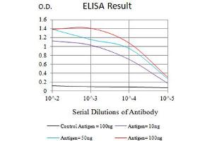 Black line: Control Antigen (100 ng),Purple line: Antigen (10 ng), Blue line: Antigen (50 ng), Red line:Antigen (100 ng) (CD8 alpha anticorps  (AA 22-182))