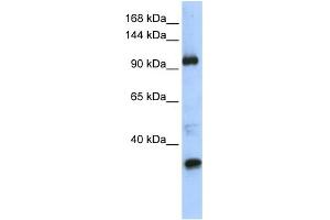 WB Suggested Anti-TUT1 Antibody Titration:  0. (TUT1 anticorps  (Middle Region))