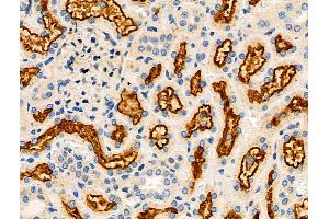 ABIN6259928 and ABIN6276407 at 1/100 staining Rat kidney tissue by IHC-P.