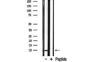 anti-S100 Calcium Binding Protein A1 (S100A1) (N-Term) antibody