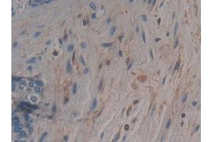 Detection of CAP2 in Human Prostate Tissue using Polyclonal Antibody to Adenylyl Cyclase Associated Protein 2 (CAP2)