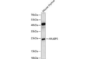Western blot analysis of extracts of mouse thymus, using IP5 antibody (ABIN7265499) at 1:1000 dilution. (ARL6IP5 anticorps  (C-Term))