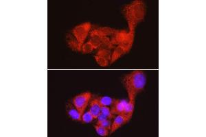 Immunofluorescence analysis of HepG2 cells using AGL antibody (ABIN7265574) at dilution of 1:100. (AGL anticorps)