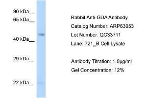 Western Blotting (WB) image for anti-Guanine Deaminase (GDA) (N-Term) antibody (ABIN2774360)