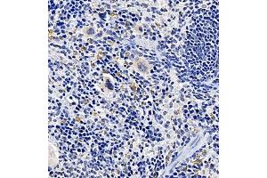 Immunohistochemistry of paraffin embedded mouse spleen using TREML1 (ABIN7076009) at dilution of 1:2200 (400x lens) (TREML1 anticorps)