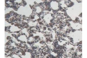 Detection of IL6 in Rat Lung Tissue using Monoclonal Antibody to Interleukin 6 (IL6)