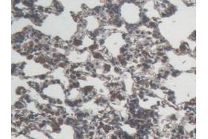 Detection of IL6 in Rat Lung Tissue using Monoclonal Antibody to Interleukin 6 (IL6) (IL-6 anticorps  (AA 25-211))