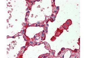 Anti-SFTPA1 / Surfactant Protein A antibody IHC staining of human lung.