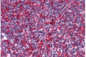 Human Tonsil: Formalin-Fixed, Paraffin-Embedded (FFPE) (EFHD2 anticorps  (N-Term))