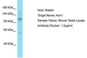 Image no. 1 for anti-Axin 1 (AXIN1) (AA 8-62) antibody (ABIN6750309) (Axin anticorps  (AA 8-62))