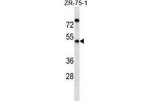 Western blot analysis in ZR-75-1 cell line lysates (35ug/lane) using EME2 Antibody (C-term).