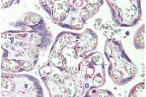 Human Placenta: Formalin-Fixed, Paraffin-Embedded (FFPE)