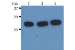 Western Blotting (WB) image for anti-HRas proto-oncogene, GTPase (HRAS) antibody (ABIN238418) (HRAS anticorps)
