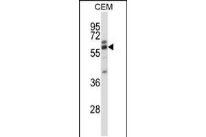 Western blot analysis in CEM cell line lysates (35ug/lane). (CORO2A anticorps  (AA 185-213))