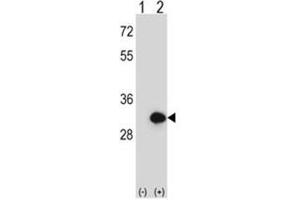 Western blot analysis of BPGM (arrow) using rabbit polyclonal BPGM Antibody (C-term) .