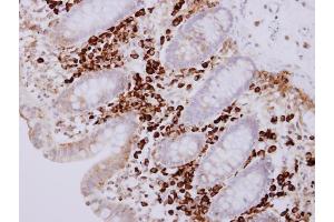 IHC-P Image PACAP antibody [N1C3] detects PACAP protein at cytosol on human normal colon mucosa with lymphocyte by immunohistochemical analysis. (MZB1 anticorps)
