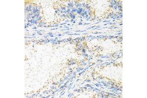 Immunohistochemistry of paraffin-embedded human prostate using NTF4 antibody at dilution of 1:100 (40x lens). (Neurotrophin 4 anticorps)