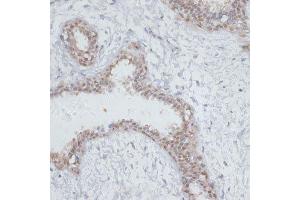 Immunohistochemistry of paraffin-embedded human breast using NOL3 antibody. (NOL3 anticorps  (AA 1-208))