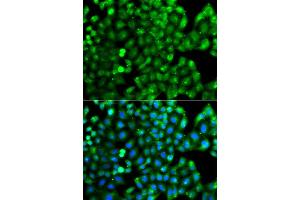 Immunofluorescence analysis of A549 cells using HLA-DRB1 antibody (ABIN5975721). (HLA-DRB1 anticorps)