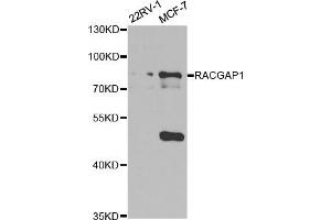 Western Blotting (WB) image for anti-Rac GTPase Activating Protein 1 (RACGAP1) antibody (ABIN1876486)