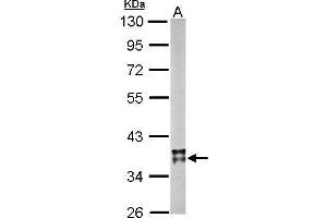 WB Image Sample (20 ug of whole cell lysate) A: mouse brain 10% SDS PAGE antibody diluted at 1:10000