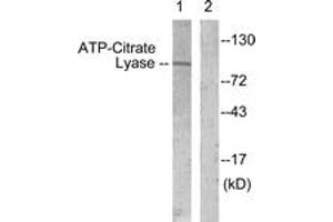 Western blot analysis of extracts from COS7 cells, treated with Calyculin 50nM 30', using ATP-Citrate Lyase (Ab-454) Antibody. (ACLY anticorps  (AA 420-469))