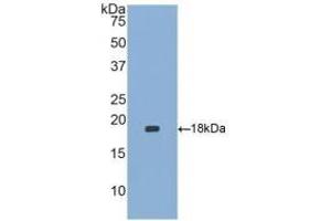 Detection of Recombinant HBEGF, Human using Polyclonal Antibody to Heparin Binding Epidermal Growth Factor Like Growth Factor (HBEGF)