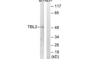 Western blot analysis of extracts from MCF-7 cells, using TBL2 antibody. (TBL2 anticorps  (C-Term))