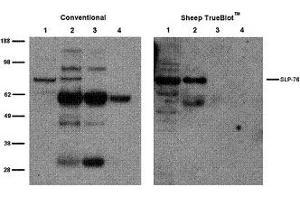 Sheep IP / Western Blot Sheep IP / Western Blot: Jurkat cell lysate (500 µg) was incubated with 2 µg of sheep anti-SLP76 and immunoprecipitated using Protein G. (Mouton TrueBlot® Anti-Mouton IgG HRP)