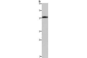 Gel: 6 % SDS-PAGE, Lysate: 40 μg, Lane: Human fetal liver tissue, Primary antibody: ABIN7129455(FAR2 Antibody) at dilution 1/1000, Secondary antibody: Goat anti rabbit IgG at 1/8000 dilution, Exposure time: 40 seconds (FAR2 anticorps)