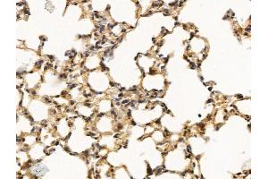 ABIN7094756 and ABIN7098807 at 1/100 staining Mouse lung tissue by IHC-P.