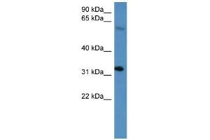WB Suggested Anti-Hoxd13 Antibody Titration: 0.