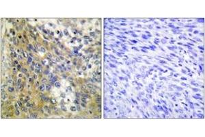 Immunohistochemistry (IHC) image for anti-Collagen, Type IV, alpha 6 (COL4a6) (AA 1201-1250) antibody (ABIN2889915) (COL4a6 anticorps  (AA 1201-1250))