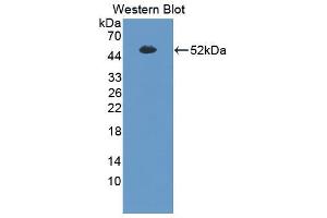 Western blot analysis of the recombinant protein. (SFTPB anticorps  (AA 201-381))