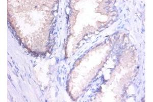 Immunohistochemistry of paraffin-embedded human spleen tissue using ABIN7156957 at dilution of 1:100 (MMP1 anticorps  (AA 101-469))