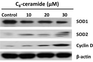 Regulation of SOD1/2 and cyclin D1 proteins induced by C8-ceramide. (SOD1 anticorps  (C-Term))