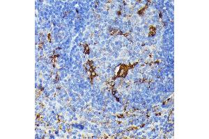 Immunohistochemistry of paraffin-embedded mouse spleen using TI antibody (ABIN6133213, ABIN6149144, ABIN6149145 and ABIN6221696) at dilution of 1:100 (40x lens). (TIAL1 anticorps  (AA 266-375))