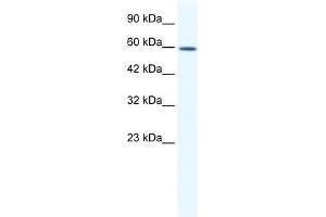 WB Suggested Anti-DDX5 Antibody Titration:  1. (DDX5 anticorps  (C-Term))